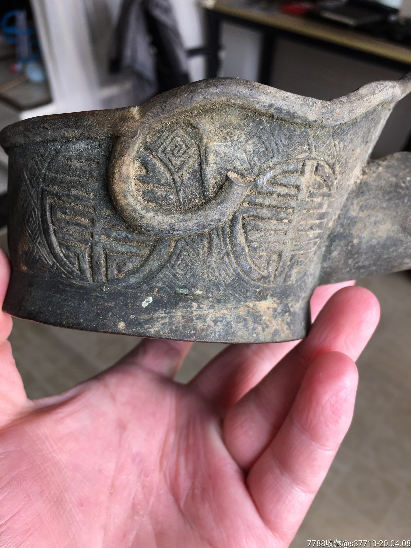 男子肾积水肚大似孕妇 给患者生活带麻烦【beat·365】(图2) beat365亚洲体育官方网站